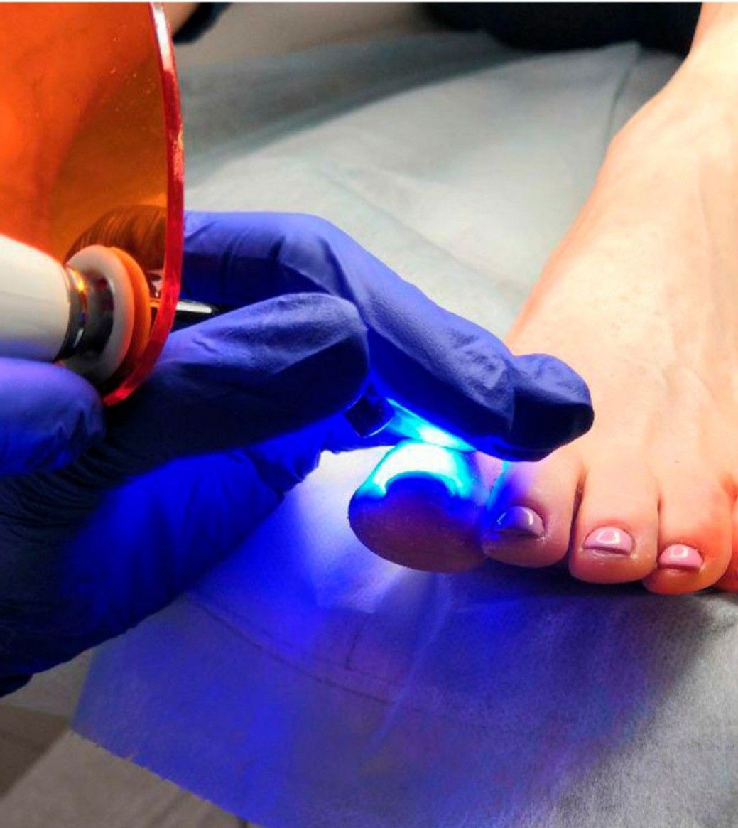 Pedicure Clínico en Valparaíso - Podología El Quinto Dedo Valparaíso
